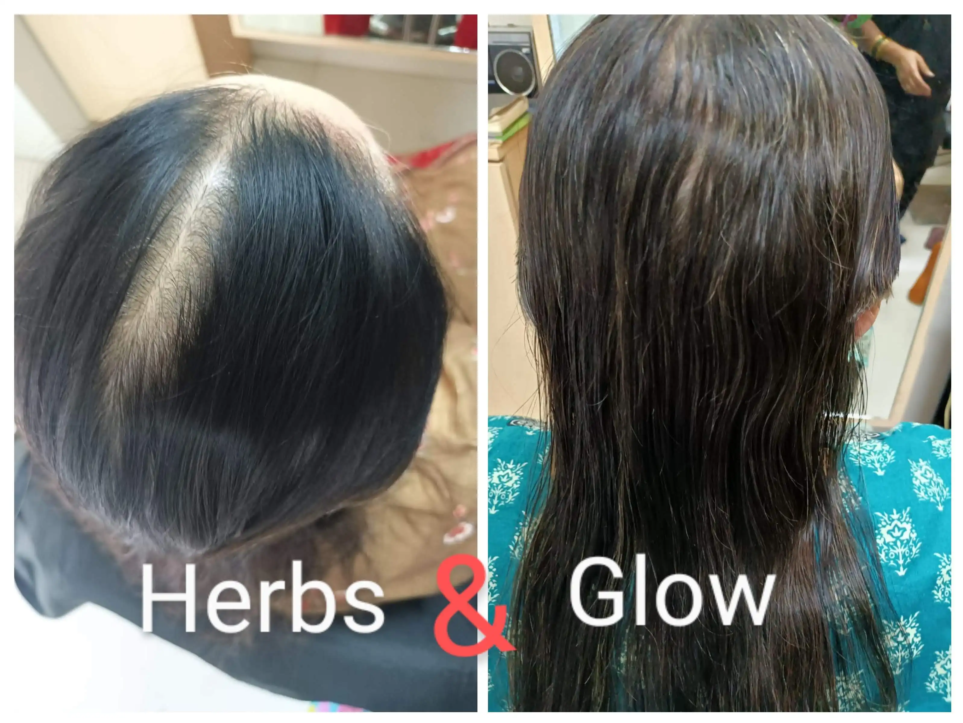 Hair Care Result 1