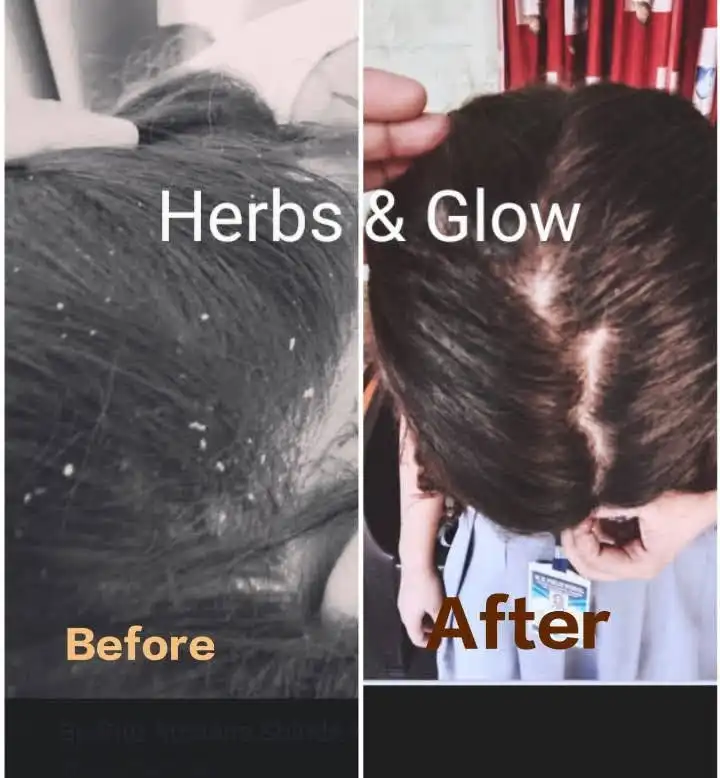 Hair Care Result 2