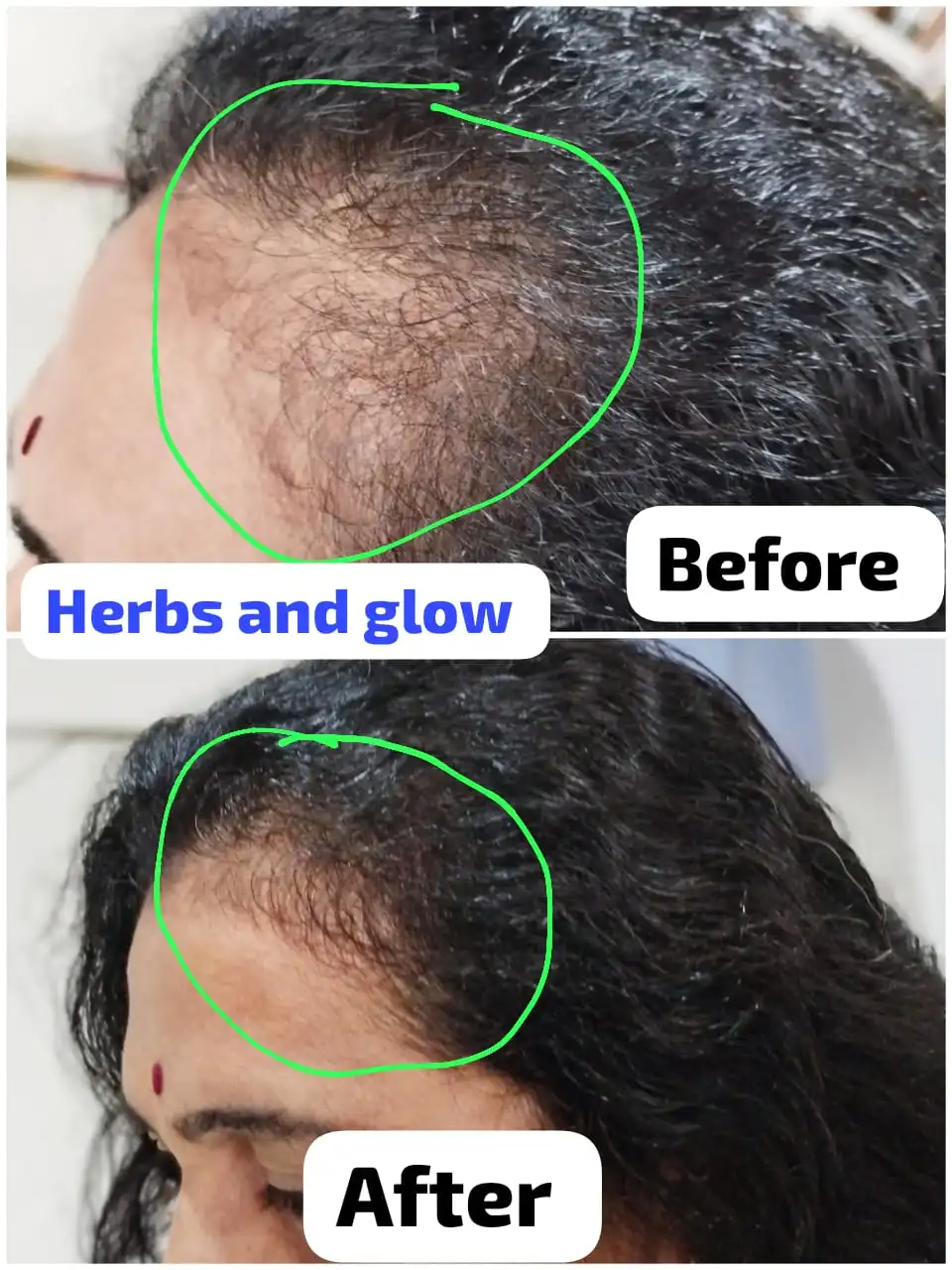 Hair Care Result 3