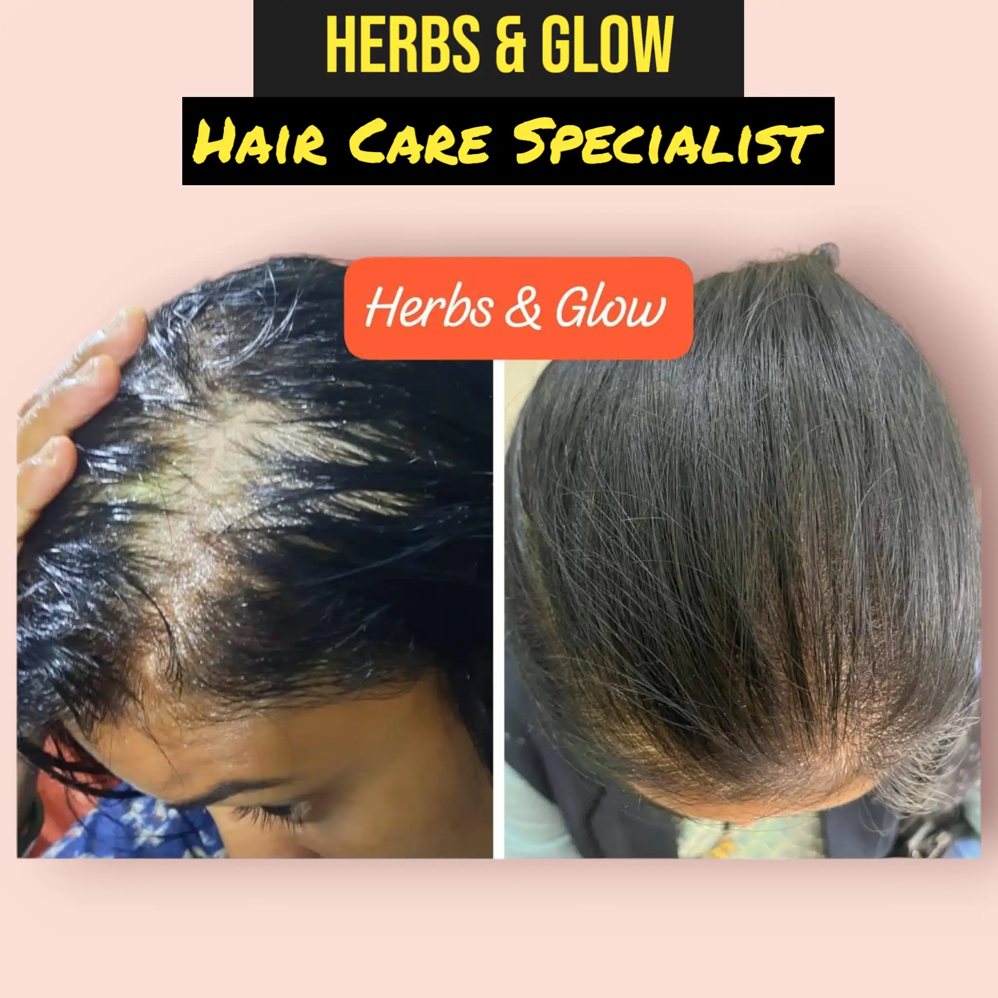 Hair Care Result 5
