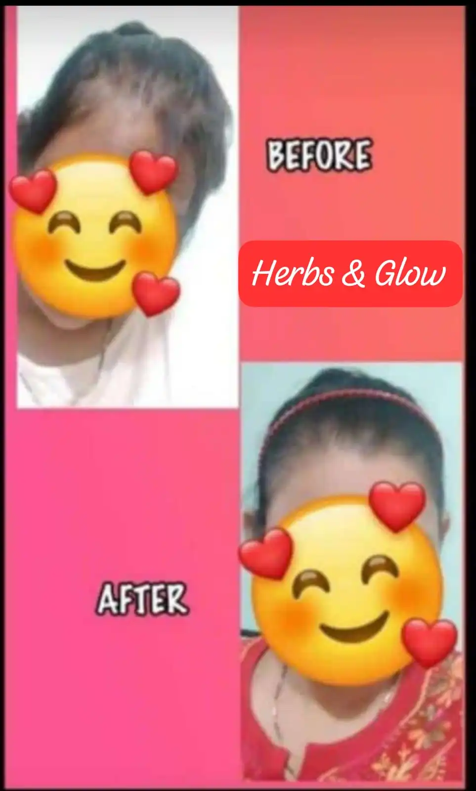 Hair Care Result 6